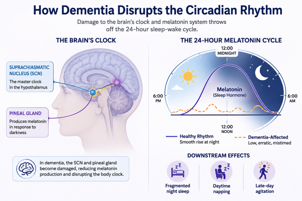 Diagram showing how dementia damages the suprachiasmatic nucleus and lowers melatonin, disrupting the 24-hour sleep-wake cycle